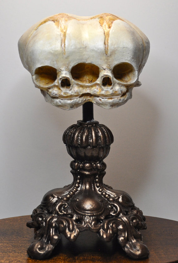 Conjoined Twins Fetal Skull Display