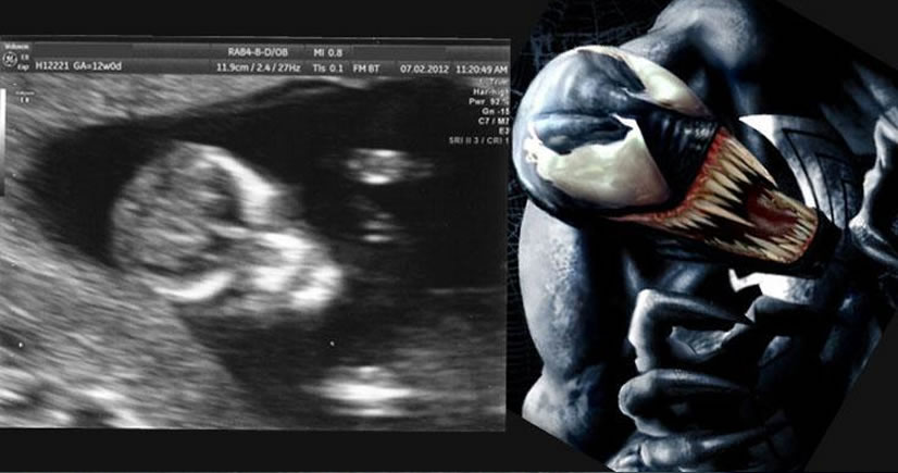 demon baby ultrasound