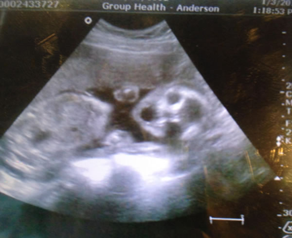 creepy_wtf_ultrasound