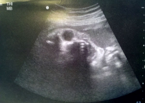 evil_ultrasound