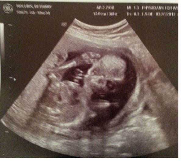 scary_ultrasound_wtf